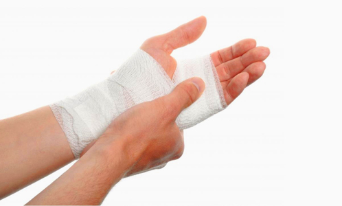 J�LET �ZLER�N�N DERMABRAZYON VE GREFTLEME �LE KAMUFLAJI